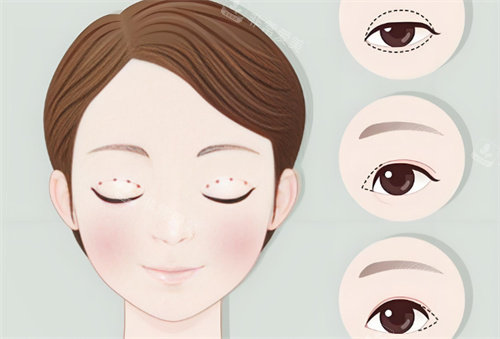 雙眼皮卡通動(dòng)畫圖