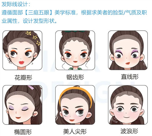 濟(jì)南熙朵植發(fā)發(fā)際線種植優(yōu)勢(shì)介紹