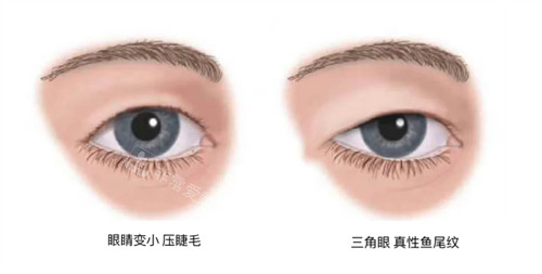 需要提眉的狀況