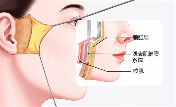 面部拉皮層次