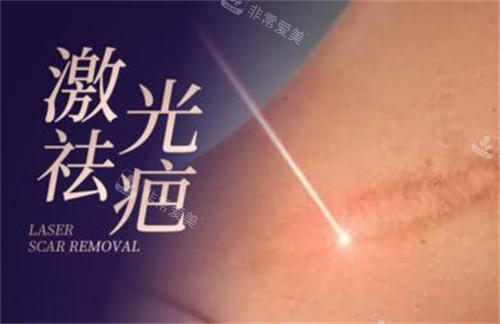 激光祛疤改善照片