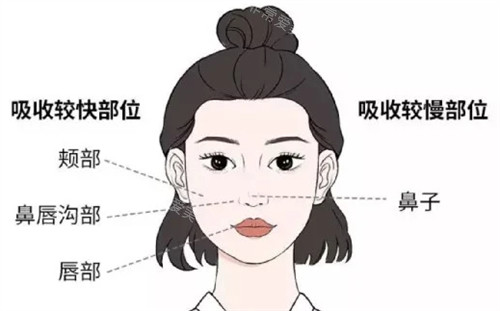 曾德浩修复馒化脸技术确实非常好！技术流程与术后自然度解析！