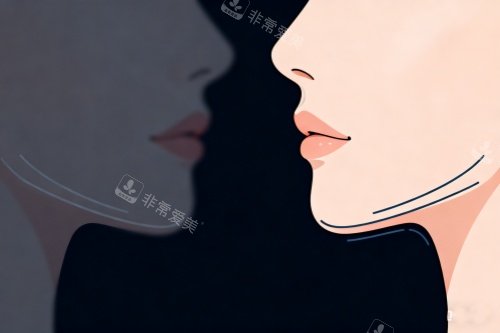双下巴提升卡通图