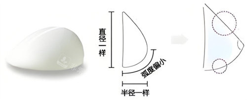 韩国做隆胸整形手术哪家医院好？盘点首尔几家在假体隆胸领域备受认可的医院！