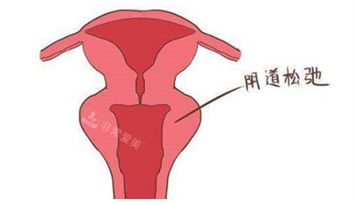 上海私密整形价钱是多少？2026价格表大全：阴道紧缩/阴唇整形/私密漂红等20+项目收费明细