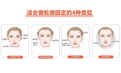 杭州轮廓固定注射好的医生有哪些?蒋铮铮、熊哲祯、肖玮、许凤芝、崔晶莹等医生大揭秘