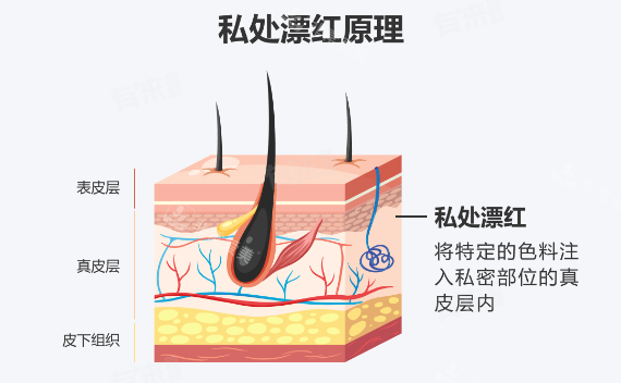 阴唇漂红原理