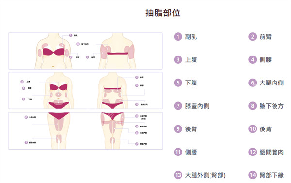 可抽脂部位
