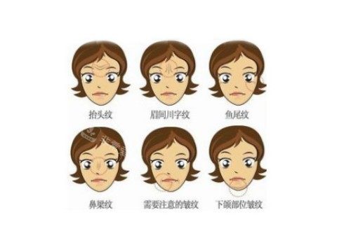 脸上皱纹