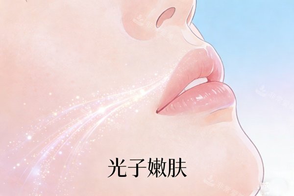 光子嫩肤卡通图片展示