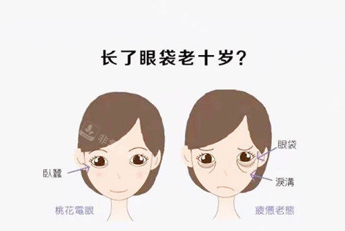 祛眼袋对比.webp