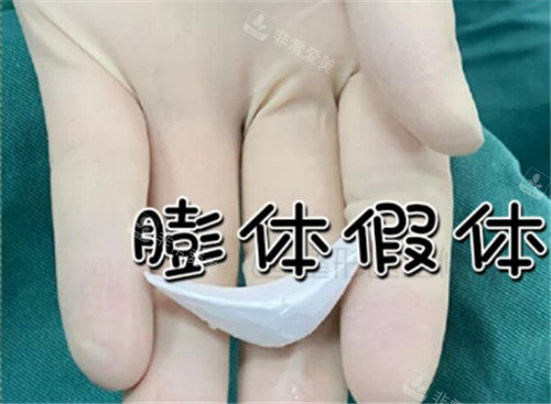 下巴假体