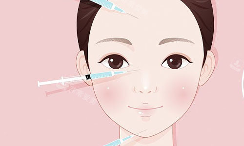 注射美容的部位示意图