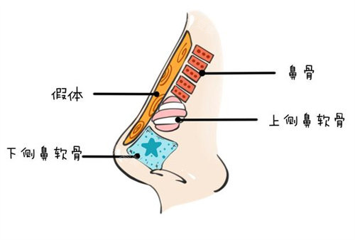 北京李劲良医生简介：坐诊柏丽，美人弧审美和维纳斯三点美学，打造专属你的妈生鼻！戳Very美学了解更多细节！
