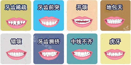 牙齿矫正不同适应症漫画图 牙齿矫正不同适应症漫画图
