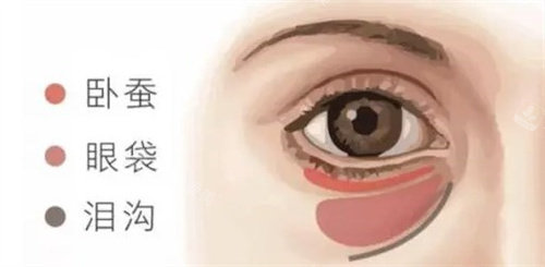 卧蚕眼袋泪沟的区别 卧蚕眼袋泪沟的区别