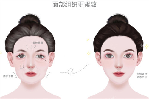 耳基底填充前后对比.jpg