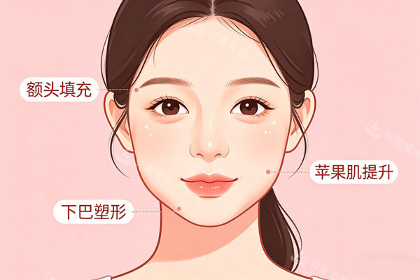 玻尿酸面部提升示意图.jpg
