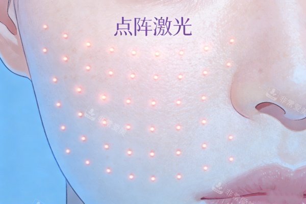 点阵激光概念图展示.jpg