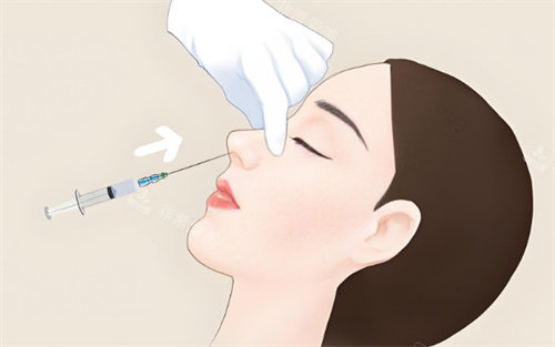 注射隆鼻
