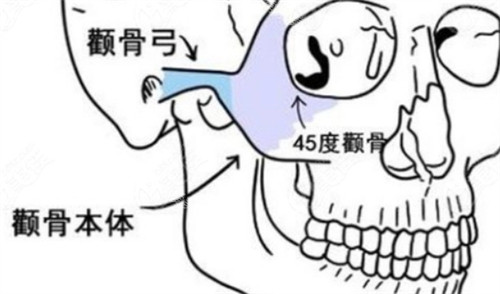 颧骨颧弓所在位置.jpg