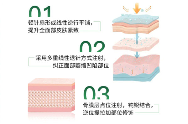 艾维岚注射皮肤层级图片.jpg