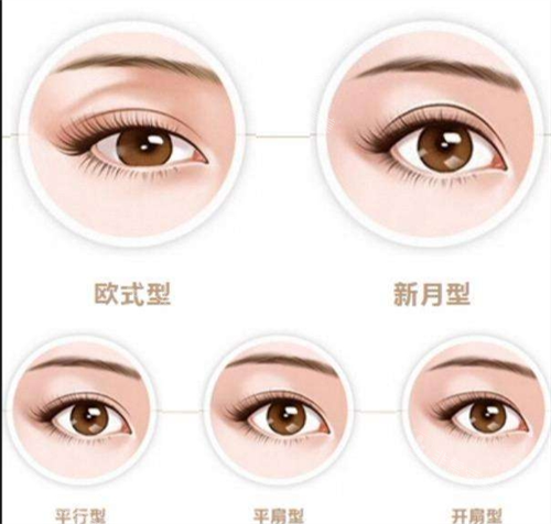双眼皮类型图示.png