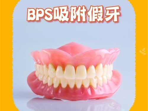 BPS吸附性义齿模型图.jpg