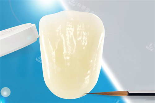 威兰德Zenostar全瓷牙成品.jpg