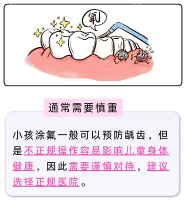 牙面涂氟注意点.jpg
