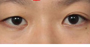 别人说我的眼睛像韩国明星金泰熙