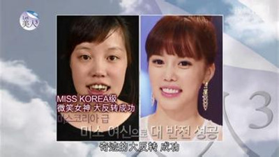 韩国let美人哪个医生做眼睛好？