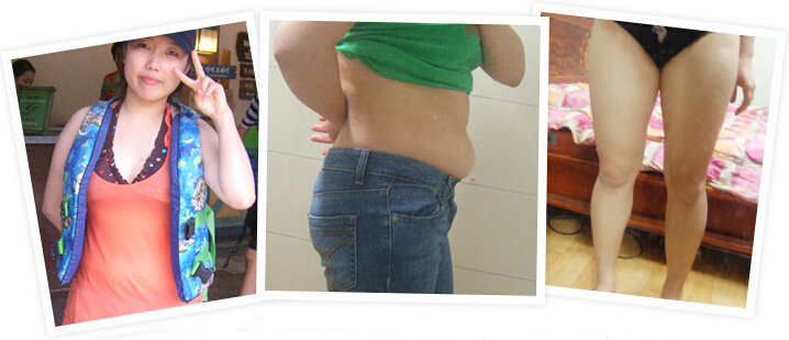 吸脂减肥一个月，站在镜子前我惊呆了！
