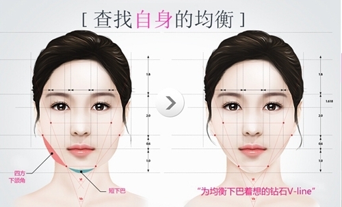 韩国v-line瘦脸手术