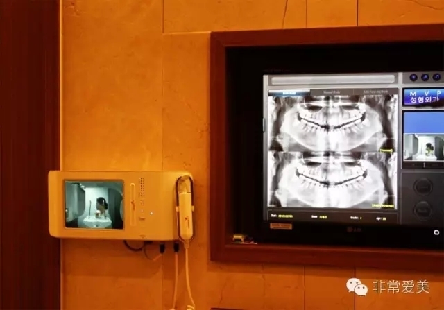 韩国MVP整形医院的3D-CT仪器演示