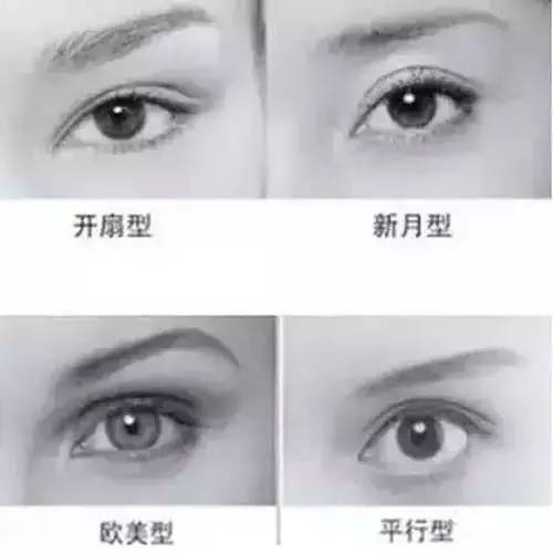 双眼皮的四种形态