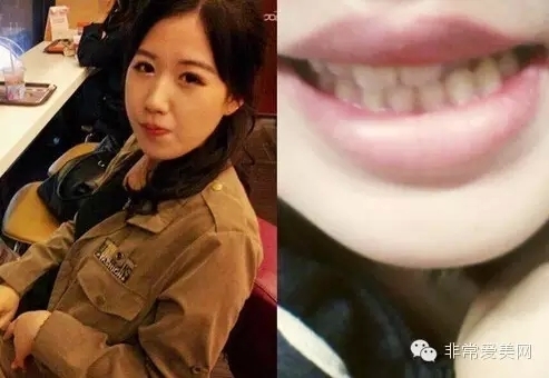 记录：24岁韩国姑娘“变脸”过程