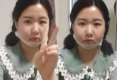 记录：24岁韩国姑娘“变脸”过程