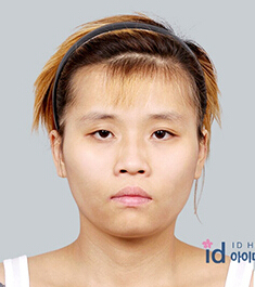 韩国ID医院《let美人》篇：“假小子”变身性感美少女