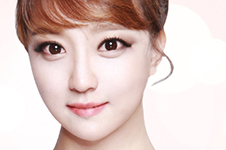 韩国女人蜕变惊人：双颚手术+埋线双眼皮+玻尿酸隆鼻