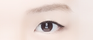 韩国LH整形外科-双眼皮整形对比日记