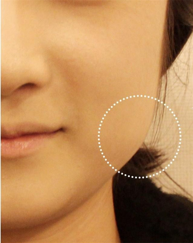 韩国Glod三星-瘦脸对比图