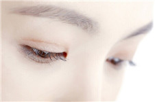 在韩国奥纳比修复双眼皮 分享我的恢复过程