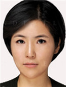 韩国灰姑娘整形医院上睑下垂矫正手术对比案例_术后