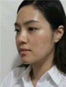 巴诺巴奇整形医院-韩国巴诺巴奇医院擅长面部轮廓吗？
