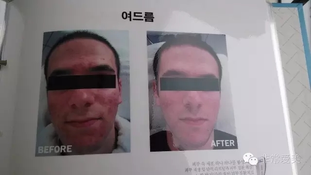 韩国整形医院面部皮肤治疗画册