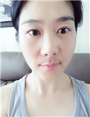 韩国首尔丽格皮肤科-我在韩国用玻尿酸填充法令纹的全过程