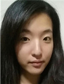 韩国秀美颜整容外科-韩国秀美颜整形外科双眼皮+隆鼻手术恢复日记