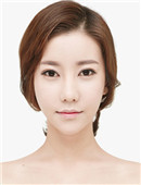 韩国TL整形外科蒜头鼻矫正手术对比案例
