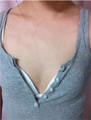 我在麦恩做完隆胸一年后的样子_术前